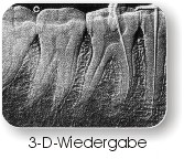 3-D-Röntgenbild